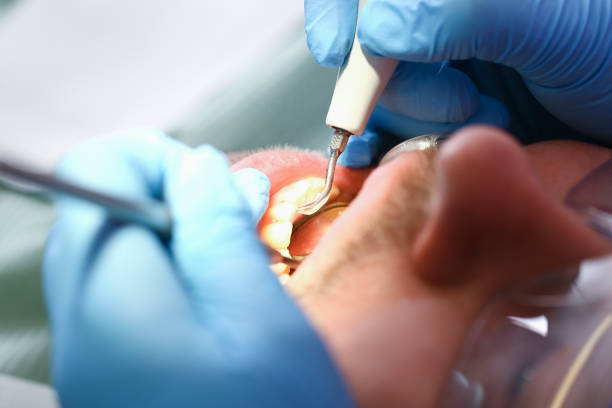 Best Emergency Treatment for Dental Infections or Abscesses in Aliquip, PA
