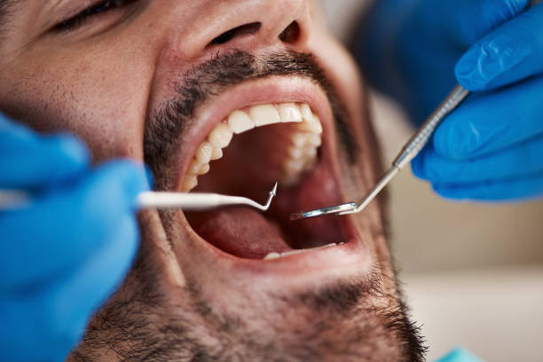 Best Emergency Treatment for Dental Infections or Abscesses in Aliquip, PA