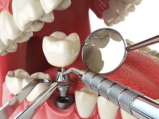 Best Urgent Care for Lost Fillings or Crowns in Aliquip, PA